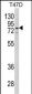 LTA4H Antibody (Center)